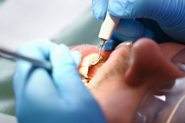 Best Same-Day Emergency Dentist in Hilliard, OH