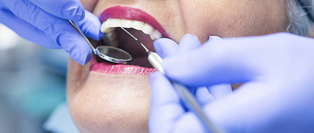 Best Emergency Treatment for Toothache in Hilliard, OH